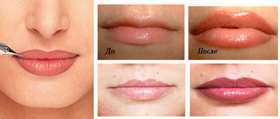 Перманентный макияж губ до и после 